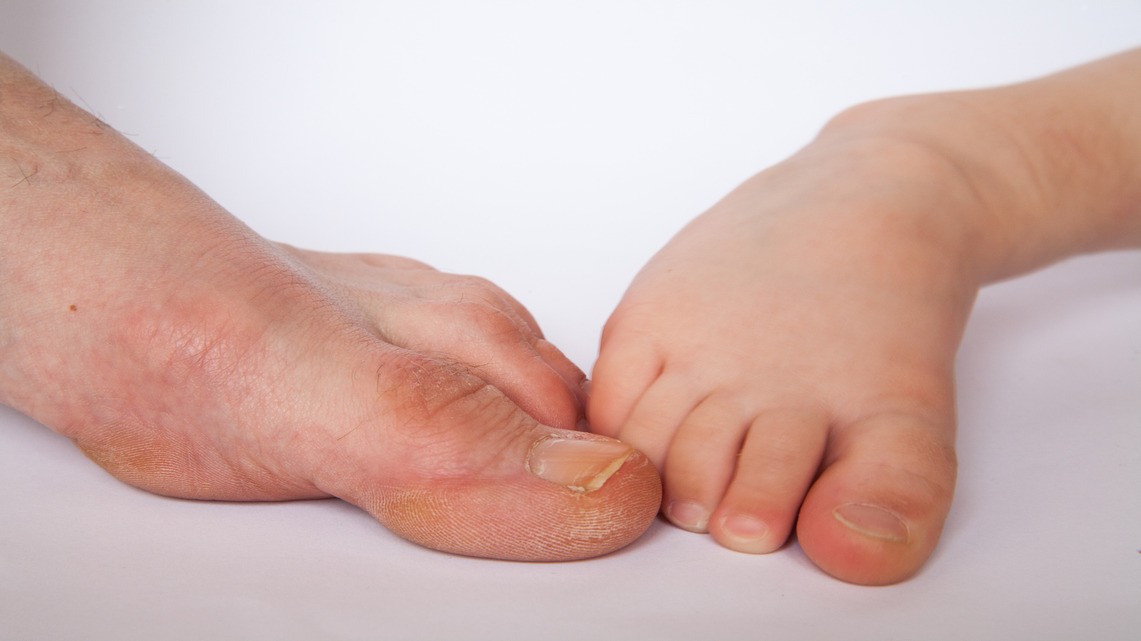The Ultimate Guide To Preventing Foot Ulcers With Diabetic Footwear | Biofoot